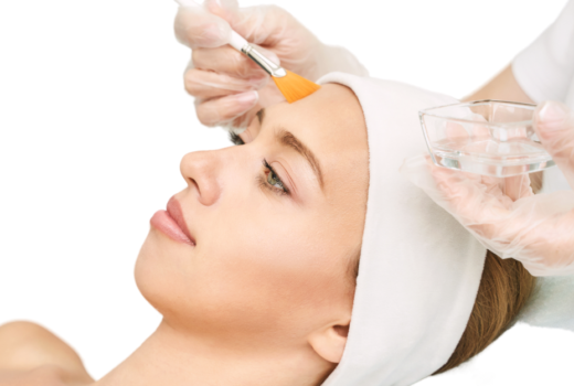 Chemical Peels